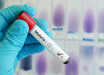 Ampule with a label