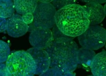 Organoids